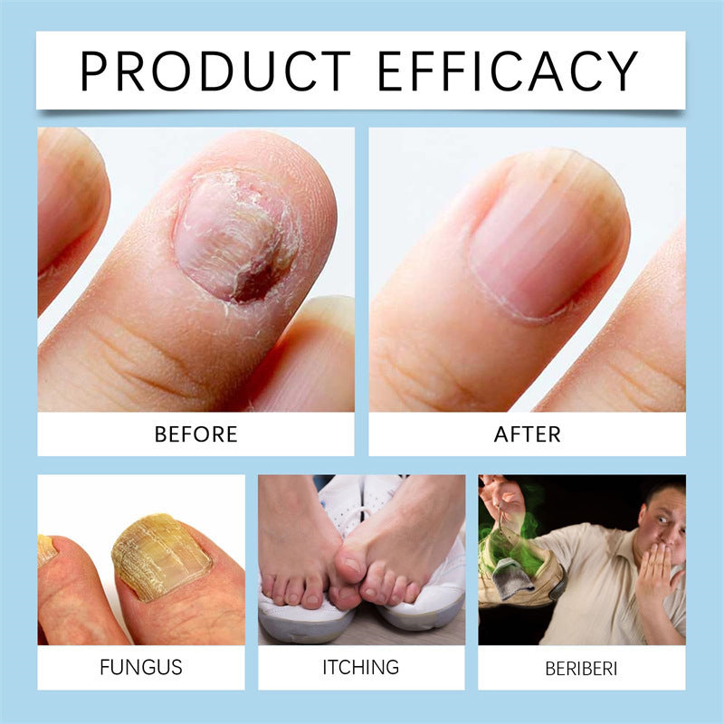 Nail Cleaning Liquid